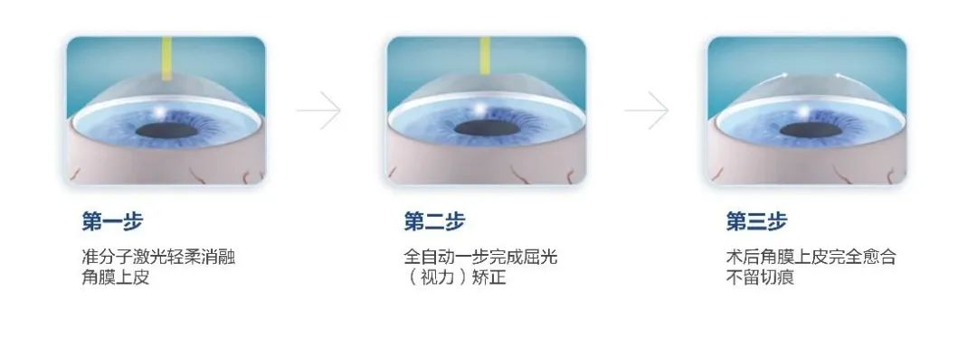 2025年海軍招飛新變化！鄭州愛爾眼科醫院游昌濤：做完近視手術也能參加選拔(圖3)